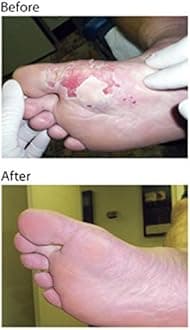 Manuka Wound Honey With Aloe 80 Grams by Eras Natural Sciences