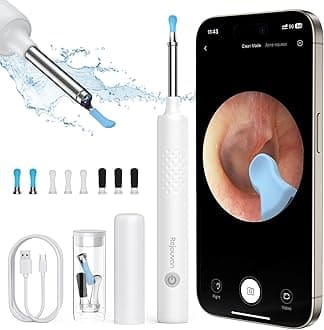 Ear Wax Removal, Ear Cleaner with Camera, Wireless Intelligent Visual Ear Picker, Earwax Removal Tool, 1080P HD Otoscope with 6 LED Lights, Ear Cleaner for iOS & Android (White)