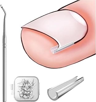 Ingrown Toenail Corrector Set - 40 Pcs Pain-Free Toenails Straightener Strips with Toe Nail Lifter - Easy Use Ingrown Toenail Tools Kit