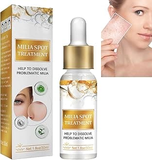 Milia Remover Serum,Milia Clearing Essence,Remover Milia Spot Treatment,Milia Spot Removal Treatment,Dark Spot Remover Face Serum,Milia Remover Milia Removal Spot Care,Milia Face Serum